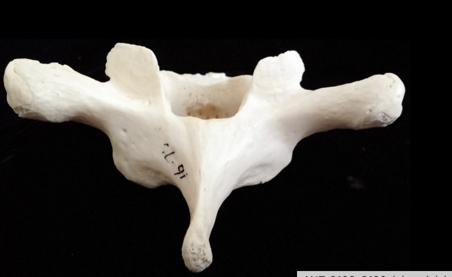 <p>what piece of the spine is this?</p>