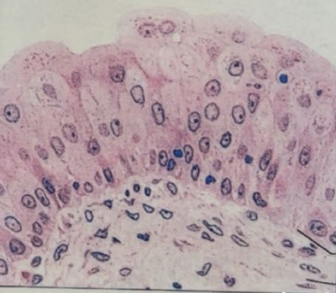 <p>transitional epithelium </p>