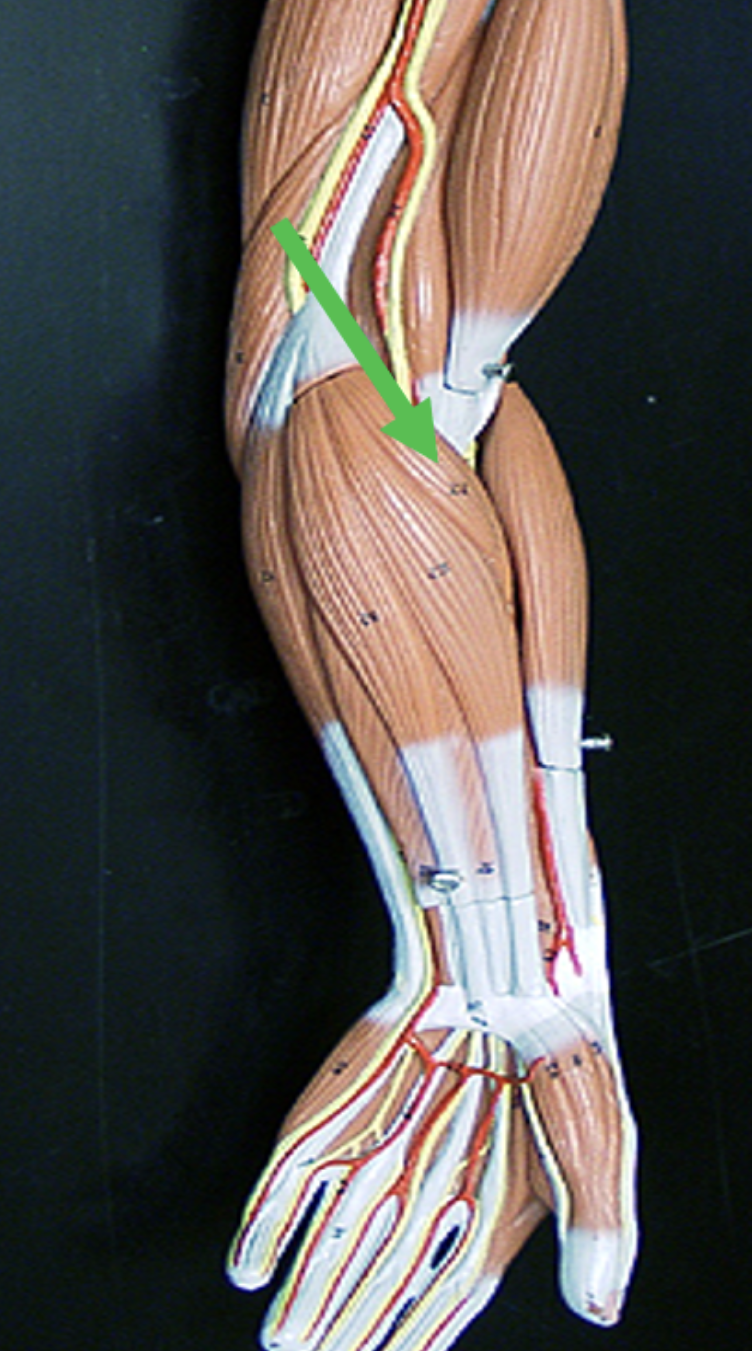 <p>Identify the muscle indicated by the pointer.</p>