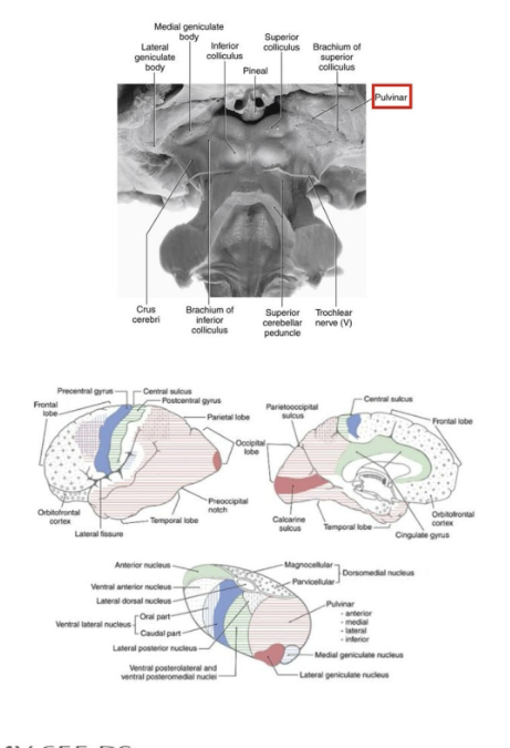 <p>Pulvinar (L pillow) projects from back of the thalamus dorsal and lateral to the midbrain. Consists of 4 subnuclei. </p><p>LP merges with pulvinar (difficult to distinguish caudal boarder)</p><ul><li><p>LP-pulvinar complex receives input from the sup. colliculus, pretectum, and visual cortex of the occipital lobe (vision) + unimodal sensory and associated cortices of the parietal and temporal lobe</p></li><li><p>Projects to multimodal association cortices of the posterior parietal lobe and lateral temporal lobe. </p></li><li><p>Major role in spacial attention. </p></li></ul><p></p>