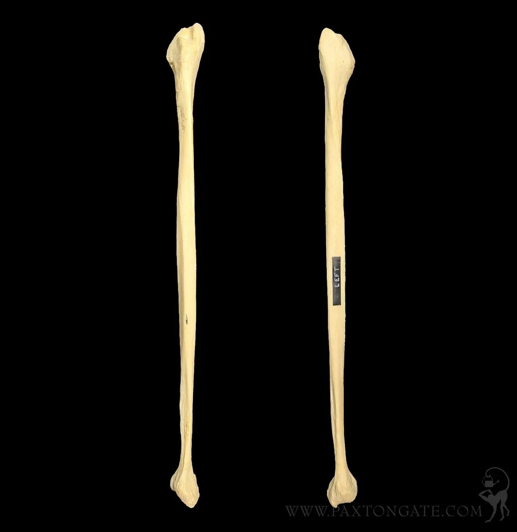 <p>What bone is this?</p>