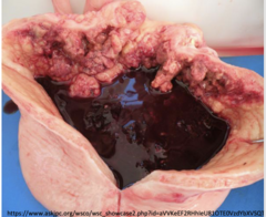 <p>Which toxin caused these gross lesions?</p>