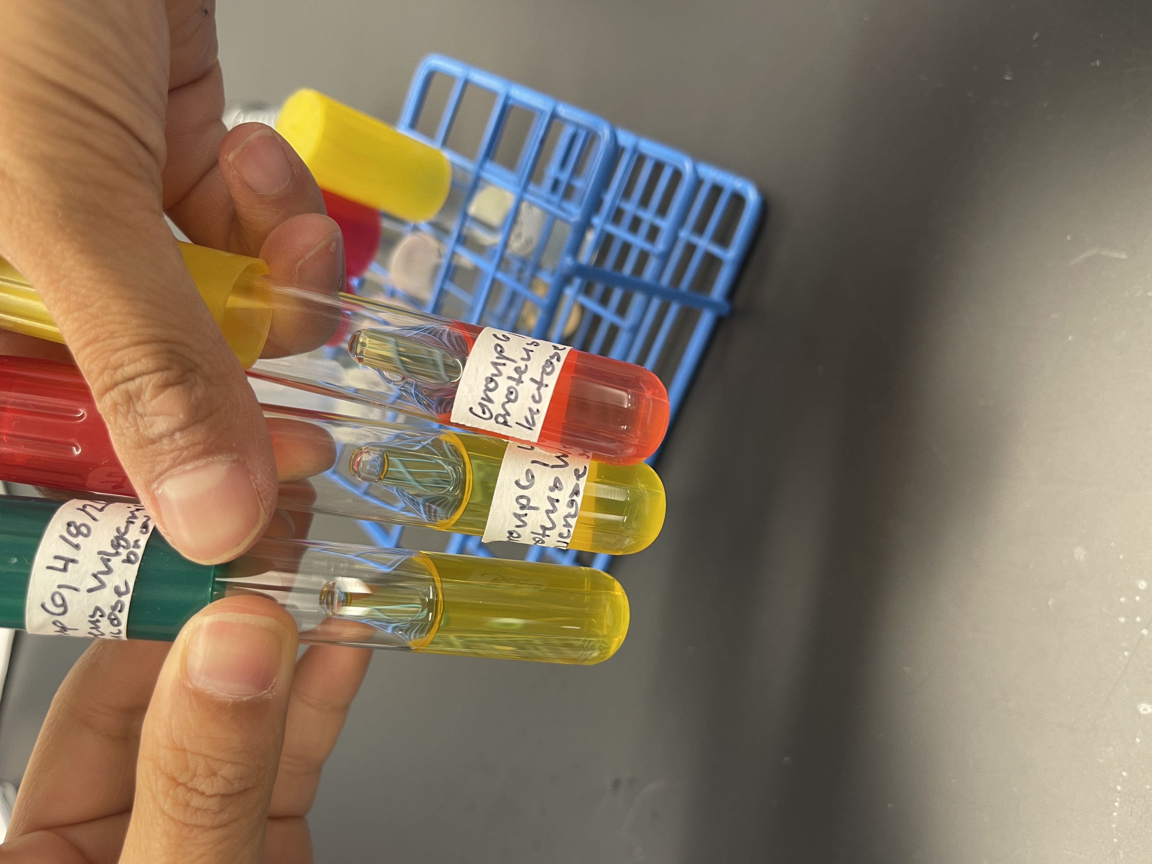<p><strong>Name: </strong>Sugar Fermentation Test</p><p><strong>PURPOSE: </strong>to determine if your organism ferments in desired sugar into an acid or acid and gas(or not at all).</p><p><strong>MEDIA: </strong>PR(Phenol Red) _________ broth (blank means it depends on what carbohydrate is there)</p><ul><li><p>Fermentable sugar (depends on what the sugar is)</p></li><li><p><span style="color: rgb(215, 36, 36);">Phenol Red</span>: pH indicator</p></li></ul><p>Acidic =<mark data-color="#dac32b" style="background-color: rgb(218, 195, 43); color: inherit;"> </mark><span style="color: rgb(0, 0, 0);"><mark data-color="#dac32b" style="background-color: rgb(218, 195, 43); color: inherit;">yellow</mark></span></p><p>Neutral = <span style="color: red;">red</span></p><p>Basic = <span style="color: rgb(222, 15, 199);">shocking pink</span></p><ul><li><p>Durham tube: traps gas(upside down glass tube, red cap, gas accumulates inside tube producing a bubble).</p></li></ul><p><strong>INOCULATION GUIDE: </strong>loopful incoculation</p><p><strong>INCUBATION: </strong>37°C for 48 hrs</p><p><strong>THEORY:</strong></p><p>Sugar is fermented —> acid (reacts with <span style="color: red;">Phenol Red</span>)</p><p><strong>RESULTS:</strong></p><p>(+) <u>For Acid ONLY: </u><mark data-color="#e1d11a" style="background-color: rgb(225, 209, 26); color: inherit;">yellow </mark>tube, no gas bubble</p><p>(+) <u>For Acid and Gas: </u><mark data-color="#ece82f" style="background-color: rgb(236, 232, 47); color: inherit;">yellow </mark>tube, gas bubble</p><p>(-) <u>For Acid and Gas: </u><span style="color: red;">red</span> or <span style="color: rgb(253, 9, 248);">shocking pink tube</span>, no gas bubble.</p>