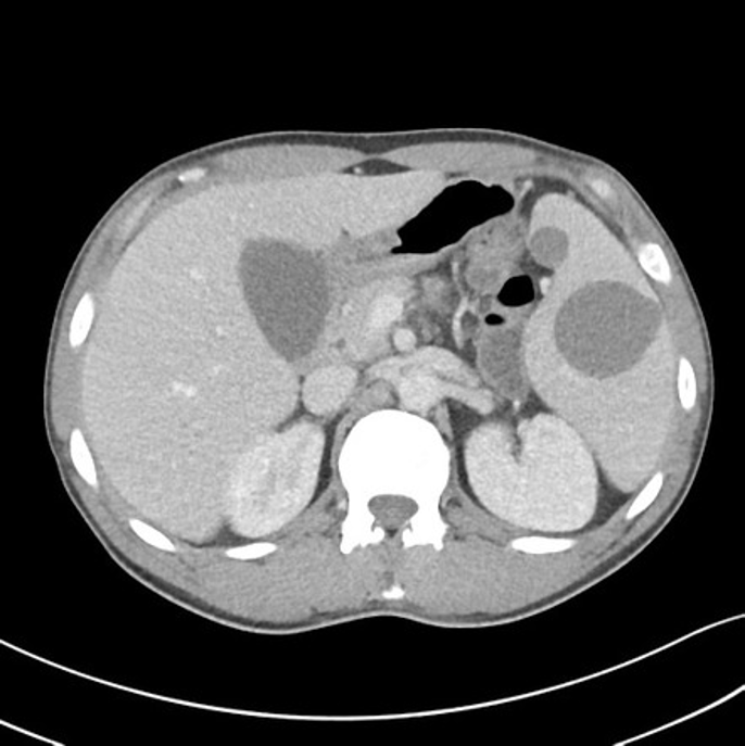 <p>what is in the spleen?</p>