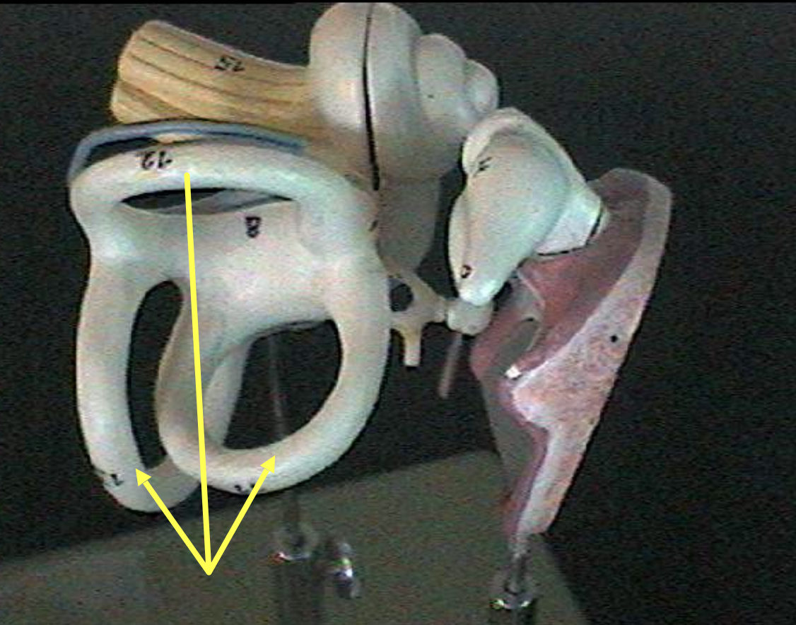 <p>Identify the inner ear parts. </p>