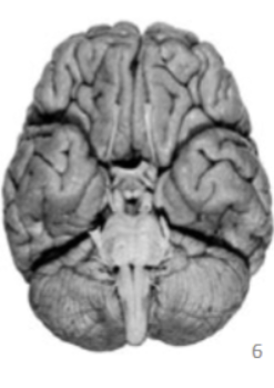 <p>brain viewpoint</p>
