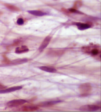 <p>What kind of tissue is shown?</p>