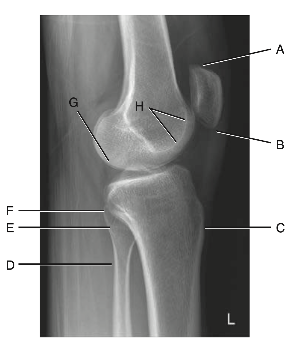 <p>C</p>