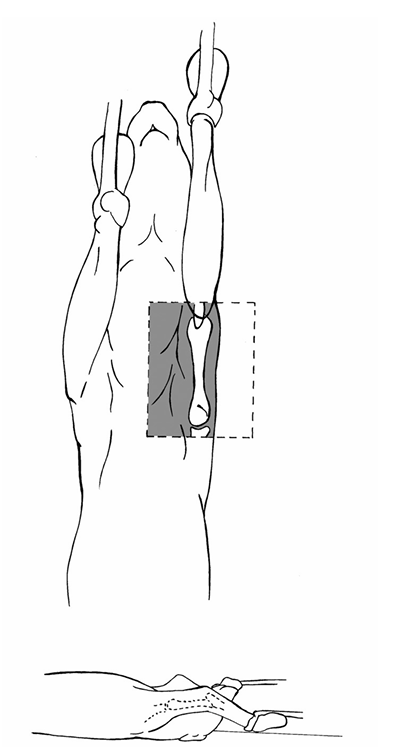 <p>Caudocranial view/ V/D</p>