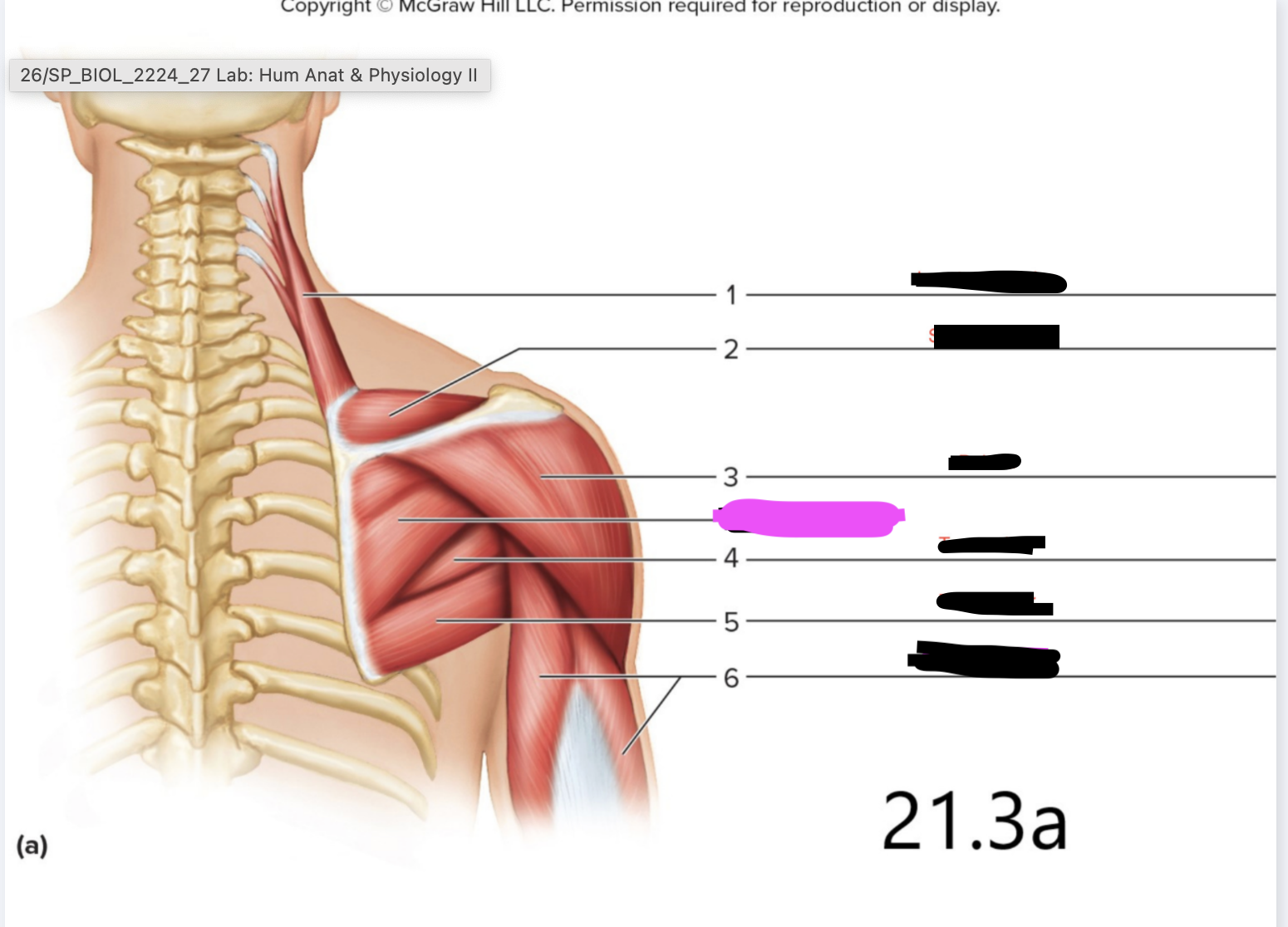 <p>Rotator Cuff Muscles</p>