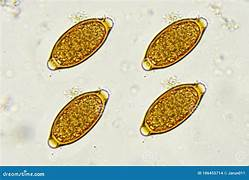 <p>Parasite or Artifact? Identify.</p>