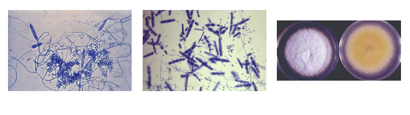 <p>ID this mold </p>