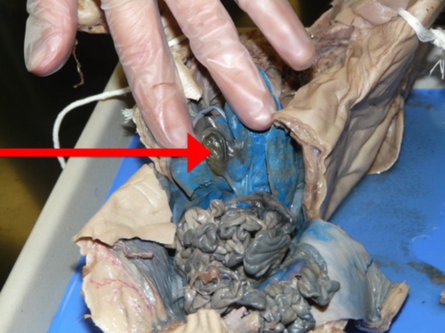 <p>This organ stores the bile produced by the liver.</p>