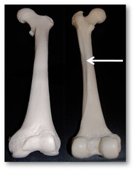 <p>name this groove </p><p>on the posterior side of the femur</p>