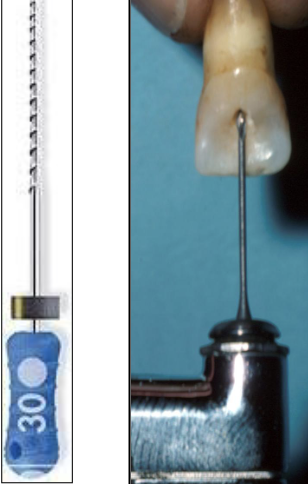 <p>If you need to remove a lingual shoulder, you can use this instrument to smooth out the access opening</p>