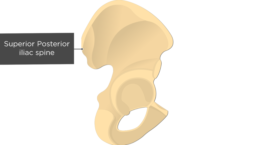 <p>Posterior Superior Iliac Spine (PSIS)</p>