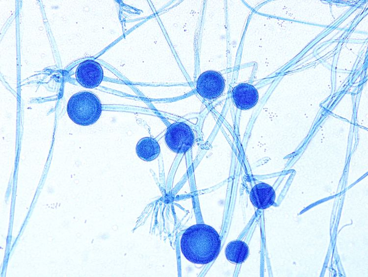 <p>The location of the sporangiophores in relation to the rhizoids is the major clue in the differentiation of Rhizopus from:</p><p>Absidia</p><p>Circinella</p><p>Cunninghamella</p><p>Mucor</p><p>Syncephalastrum</p><p>(picature is rhizoid)</p>