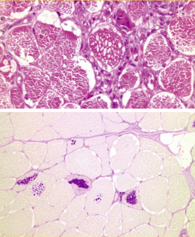<p>What is this image showing? Top stained with H&amp;E bottom stained with PAS.</p>