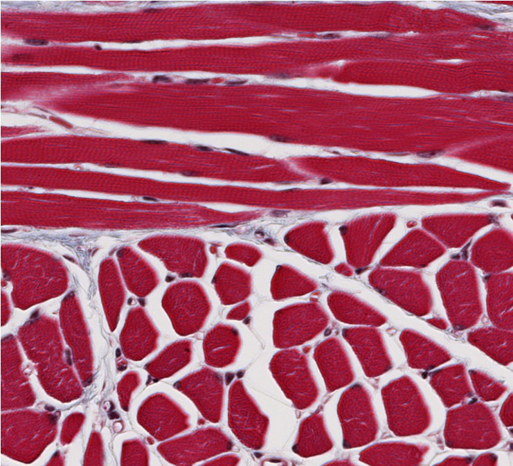 <p><span style="font-family: "Calibri Light";">ID the type of muscle.</span></p>