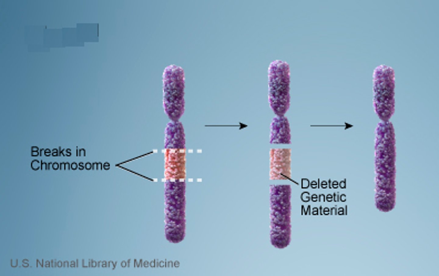 <p>A change to a chromosome in which a fragment of the chromosome is removed.</p>