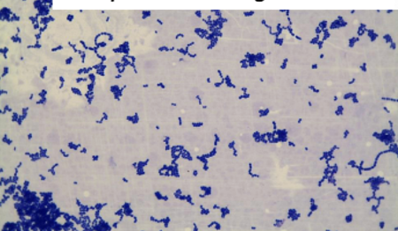 <p>Bacteria species:</p><p>Acid-fast + / - : </p><p></p>