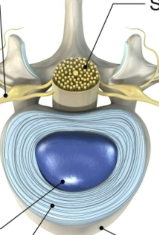 <p>Two Components of Intervertebral Disc</p>