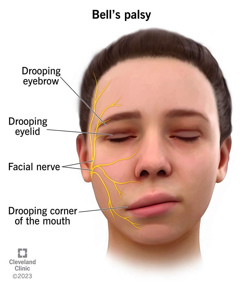 <p>What injury / condition? </p>