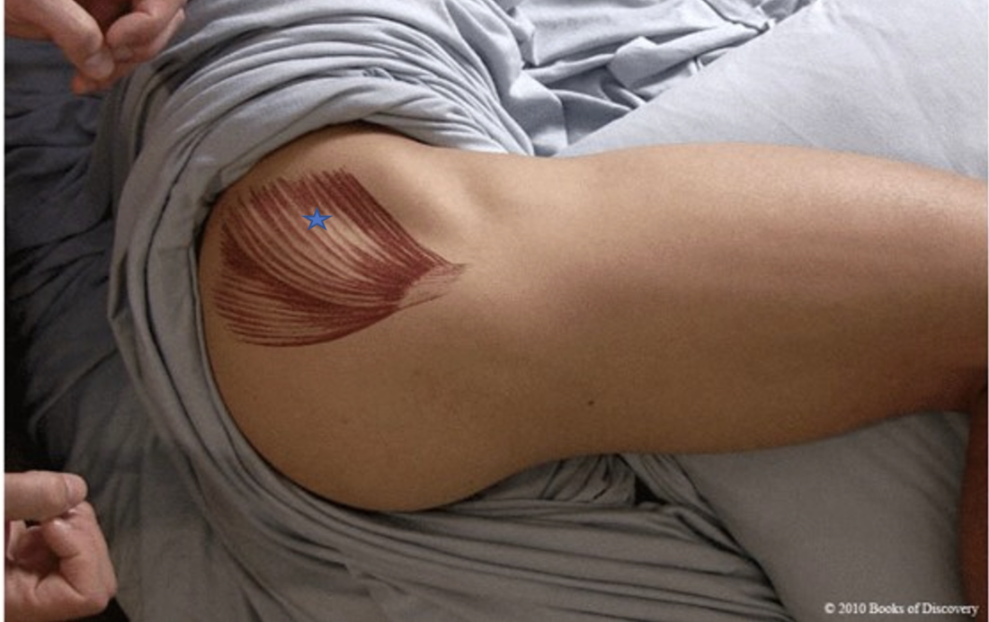 <p><span>From the list of muscles and actions below, identify the "starred" muscle and its primary actions.</span></p>