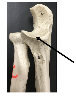 <p>What bone and bone feature is this?</p>