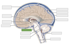 <p>This is the</p>