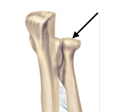 <p>Identify the anatomical feature of the radius.</p>