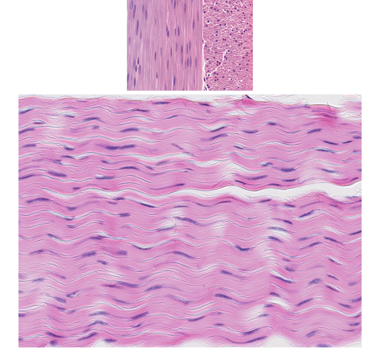 <p><span style="font-family: "Calibri Light";">1. Which basic type of CT is this?<br><br>2. Can you be more specific?</span></p>