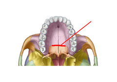 <p>What type of suture is shown?</p>