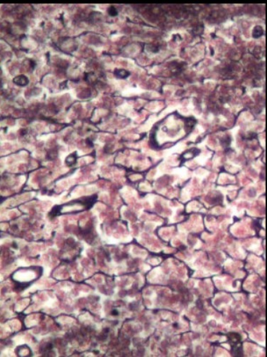 <p>What is the type tissue in this image?</p>