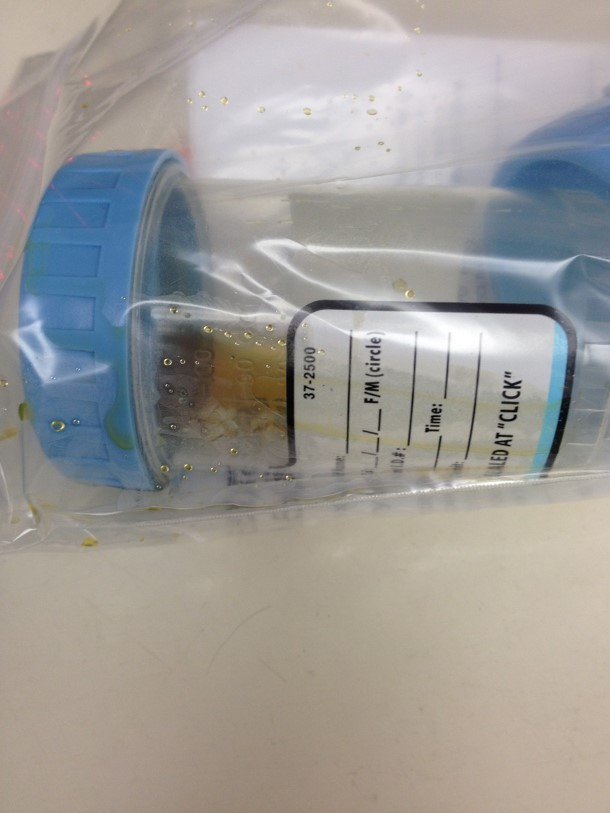 <p>T/F: This specimen is acceptable for culture </p>