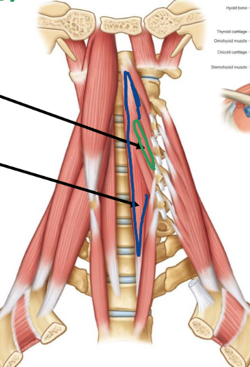 <ul><li><p>longus colli</p></li><li><p>oblique portion</p><ul><li><p>O: bodies/transverse process of C3-5</p></li><li><p>I: C5, C6 vertebrae</p></li></ul></li><li><p>linear portion</p><ul><li><p>O: bodies of C5-T3</p></li><li><p>I: bodies of C2-C4 (linear)</p></li></ul></li><li><p>A:</p><ul><li><p>bilaterally: flexes cervical spine</p></li><li><p>unilaterally: ipsilateral lateral flexion cervical spine</p></li></ul></li><li><p>N: C2-C6 ventral rami</p></li></ul><p></p>