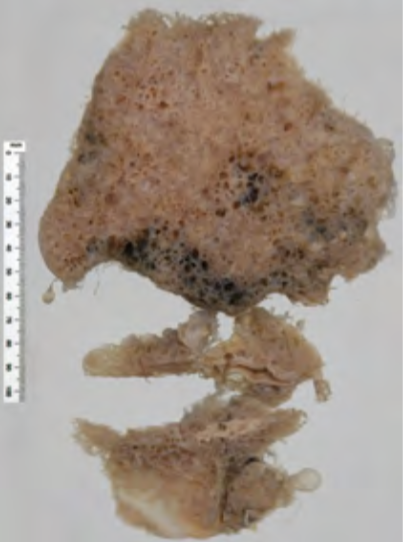 <p>Identify the POT</p>