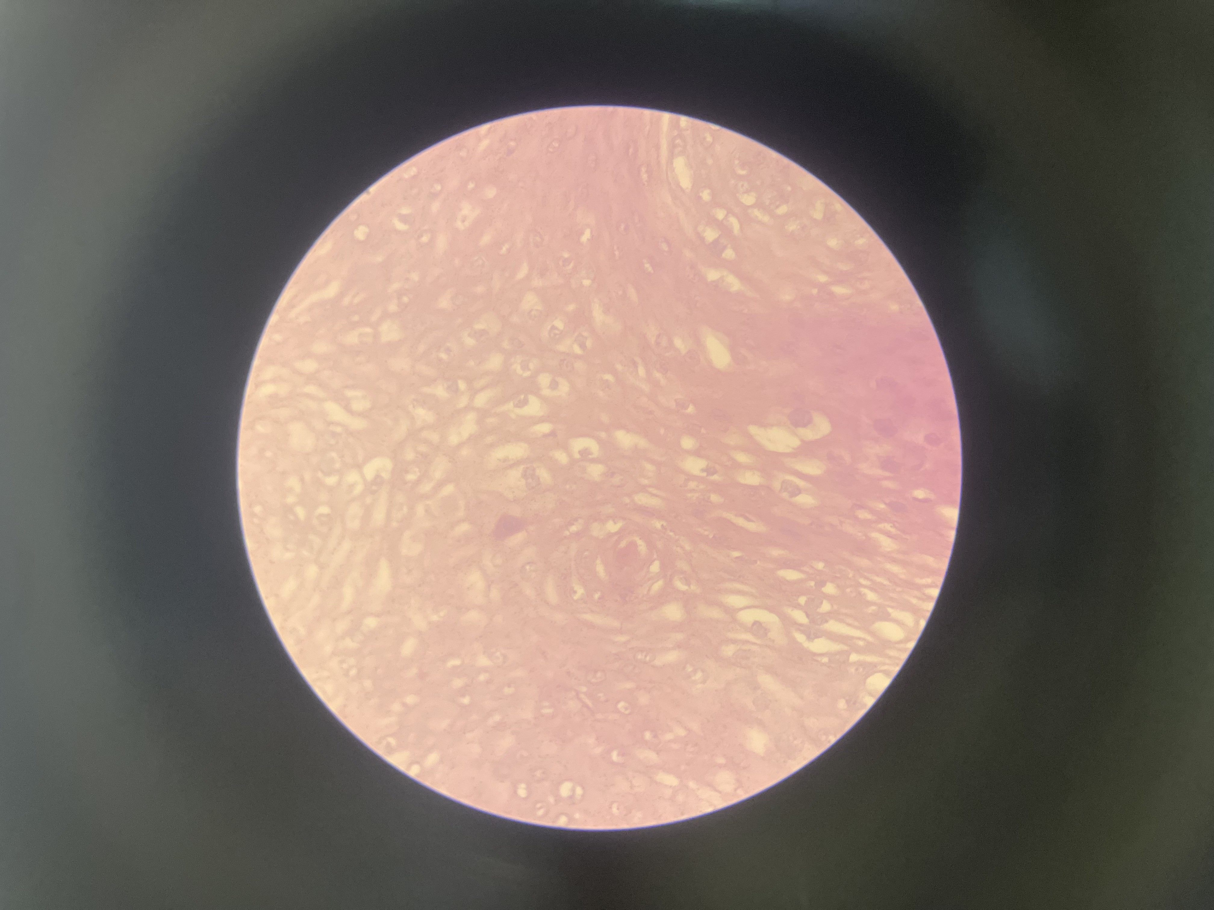 <p>What is the diagnosis?</p>