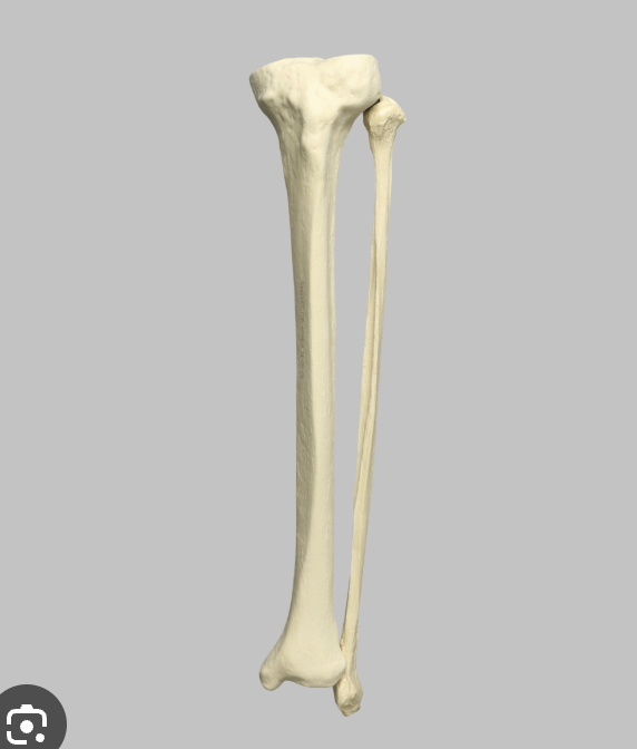 <p>Left tibia</p>