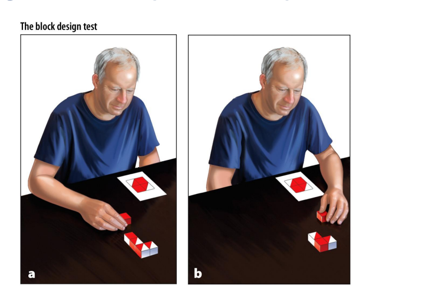 <ul><li><p>split-brain patients asked to view chimeric faces (faces composed of two different sides) —> asked to point to the face shown —> accuracy much greater with left hand than right</p></li><li><p>also held for abstract forms</p></li></ul><p></p>