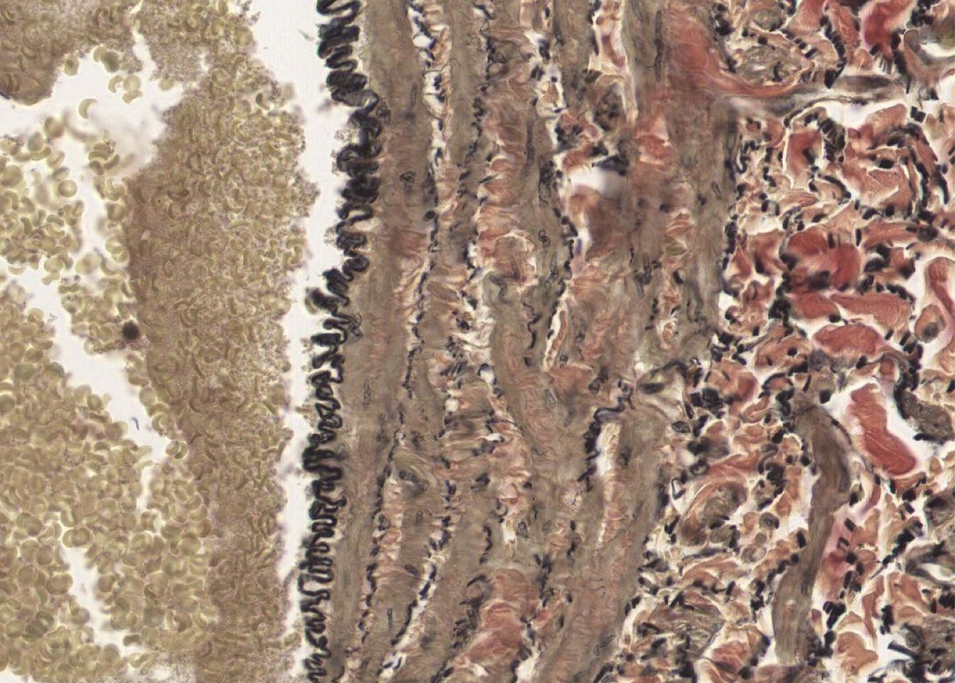 <p>Identify the Vessel and the Layer pictured</p>