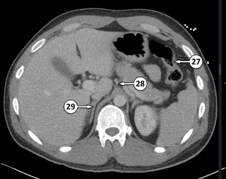 <p>What is 27 and 28?</p>