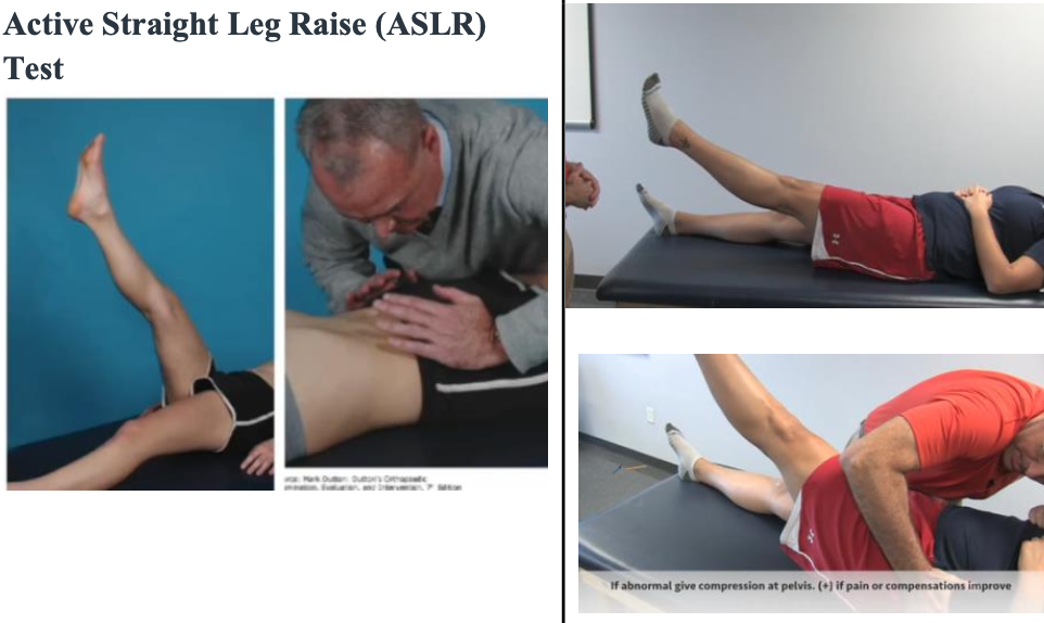 <p><strong>Purpose:</strong> Identify proper stabilization of the pelvic girdle</p><p></p><p><strong>How to Perform:</strong></p><ol><li><p>Patient supine</p></li><li><p>Patient actively lifts one straight leg off table</p></li><li><p>Watch for pain, pelvic rotation/SB, rib flare, abdominal bulging, or Valsalva</p></li><li><p>If abnormal (pain or compensation), add manual pelvic compression medially</p></li></ol><p></p><p><strong>Positive Test: </strong>Pain/compensation improves with compression</p><p></p><p><strong>Interpretation:</strong></p><ul><li><p>Suggests force closure deficit</p></li><li><p>Anterior compression helps = may need TrA stabilization</p></li><li><p>Posterior compression helps = may need multifidus stabilization</p></li></ul><p></p>