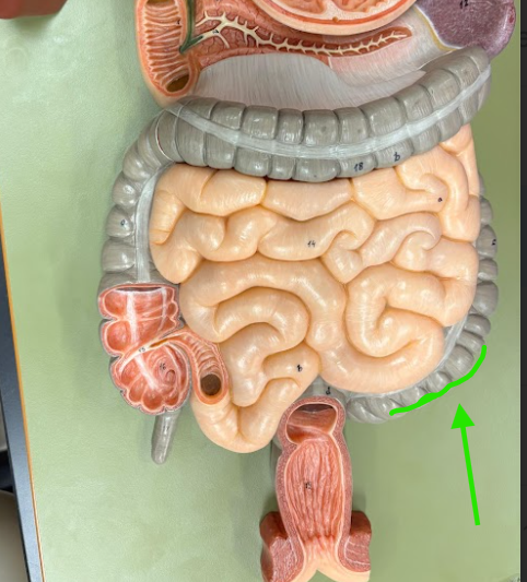 <p>What is the arrow pointing at?</p>