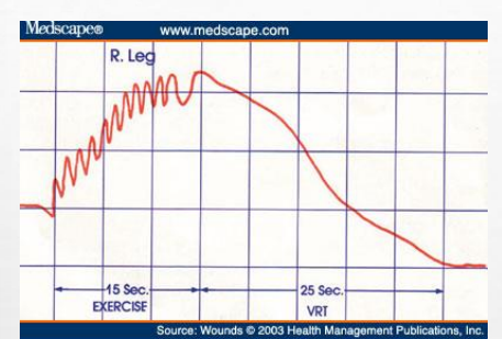 <p>Is this normal or abnormal</p>