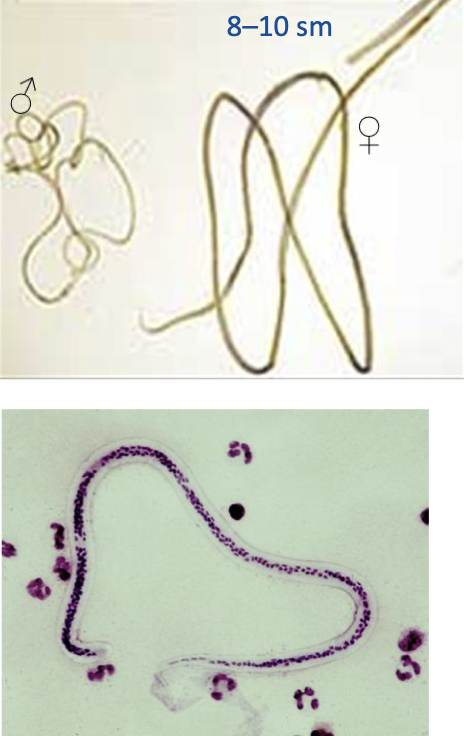 <ul><li><p>adult and larva form </p></li><li><p>thread-like filarial roundworm </p></li><li><p>causes lymphatic filariasis</p></li></ul><p></p>