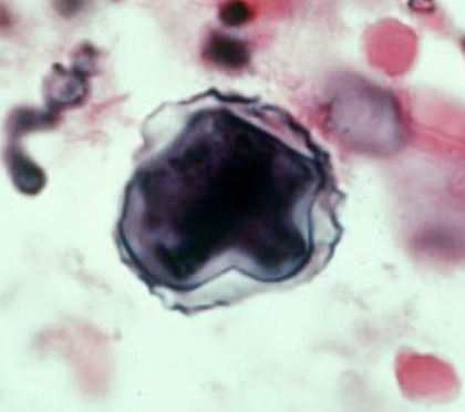 <p>Which amoeba is this? What form?</p>