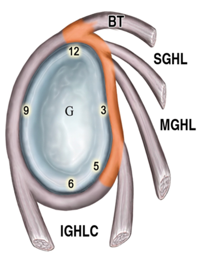 <p>Superior gleno-humeral ligament (SGHL)</p><p>Middle gleno-humeral ligament (MGHL)</p><p>Inferior gleno-humeral ligament (IGHL)</p>