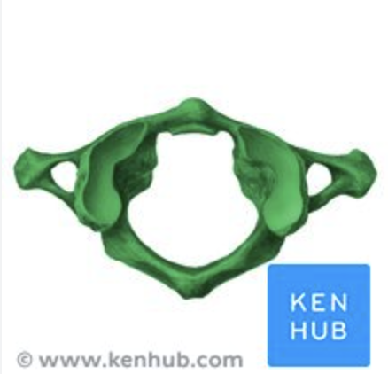 <p>Identify the vertebra</p>