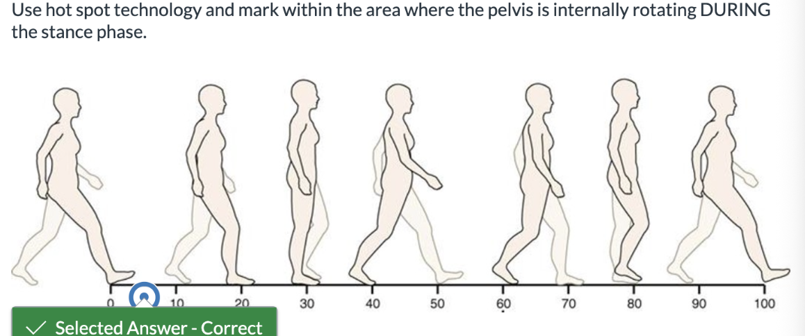 <p><span>Use hot spot technology and mark within the area where the pelvis is internally rotating DURING the stance phase.</span></p>